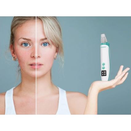 Beper - Rechargeable Pore Cleaner USB/5V 400 mAh